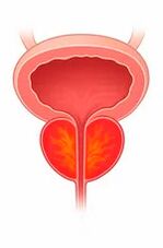 Inflamación da glándula prostática